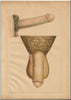 Fold-out Anatomical Diagram of Penis and Testicles c. 1910